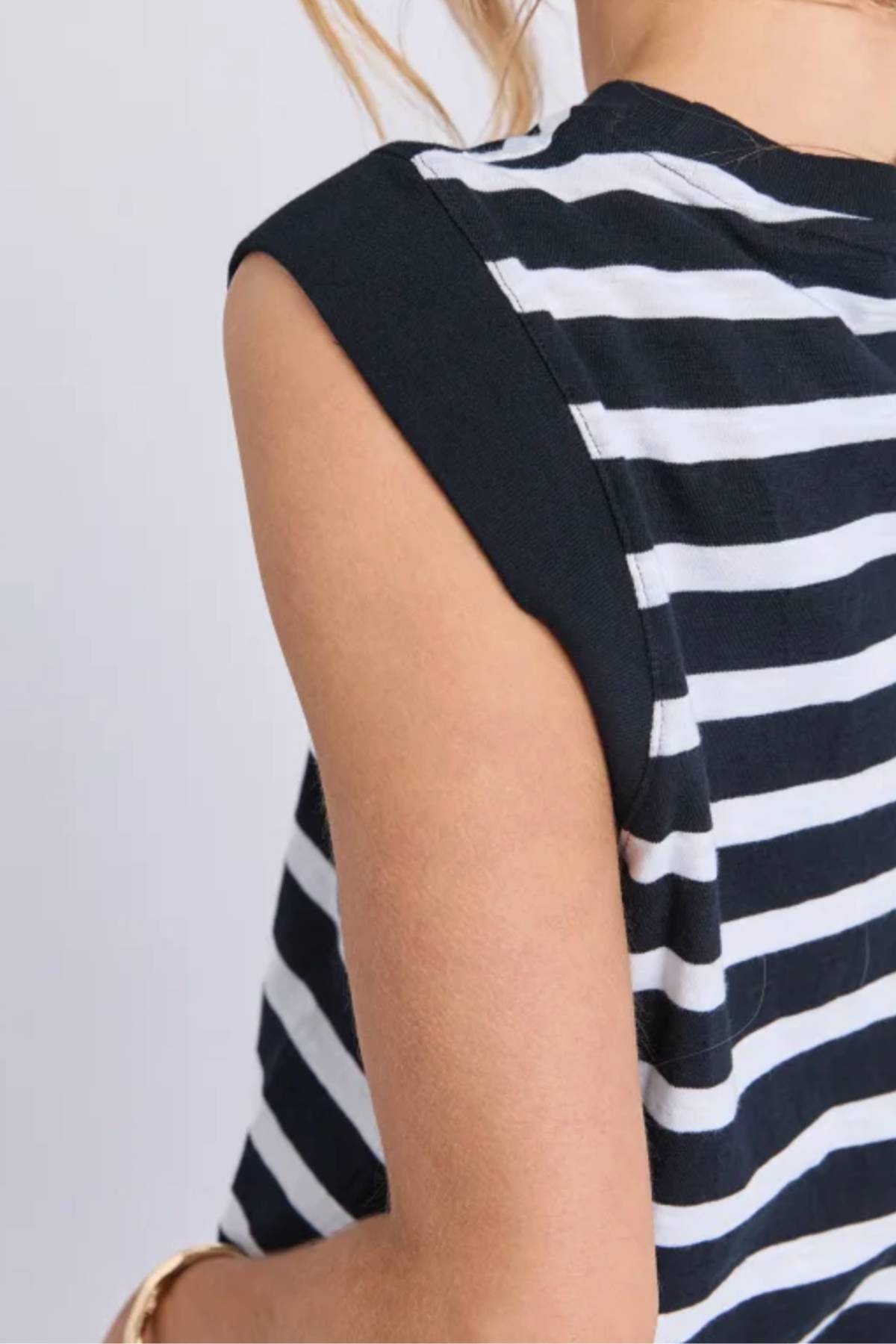 A close-up shows the Foxwood Reform Stripe Dress, a sleeveless cotton dress in black and white stripes. Only the shoulder, upper arm, and part of the back are visible, with blonde hair slightly peeking at the top.